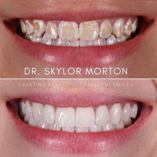 Images Nashville Wisdom Teeth and Implant Solutions