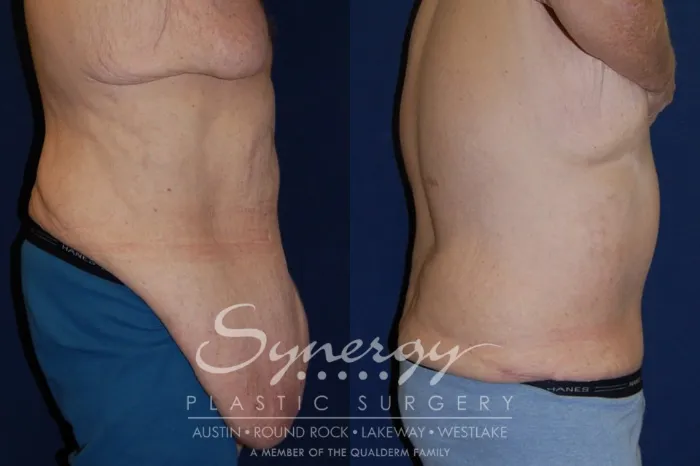 Synergy Plastic Surgery