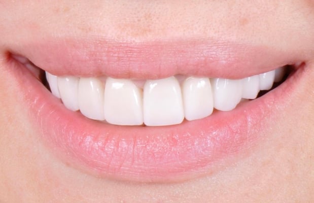 Images Milestone Family Dental