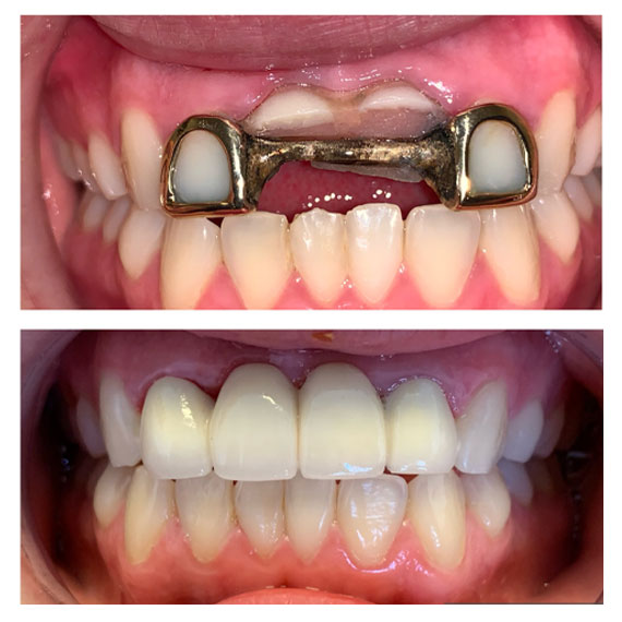 Cortes Family Dentistry- puente