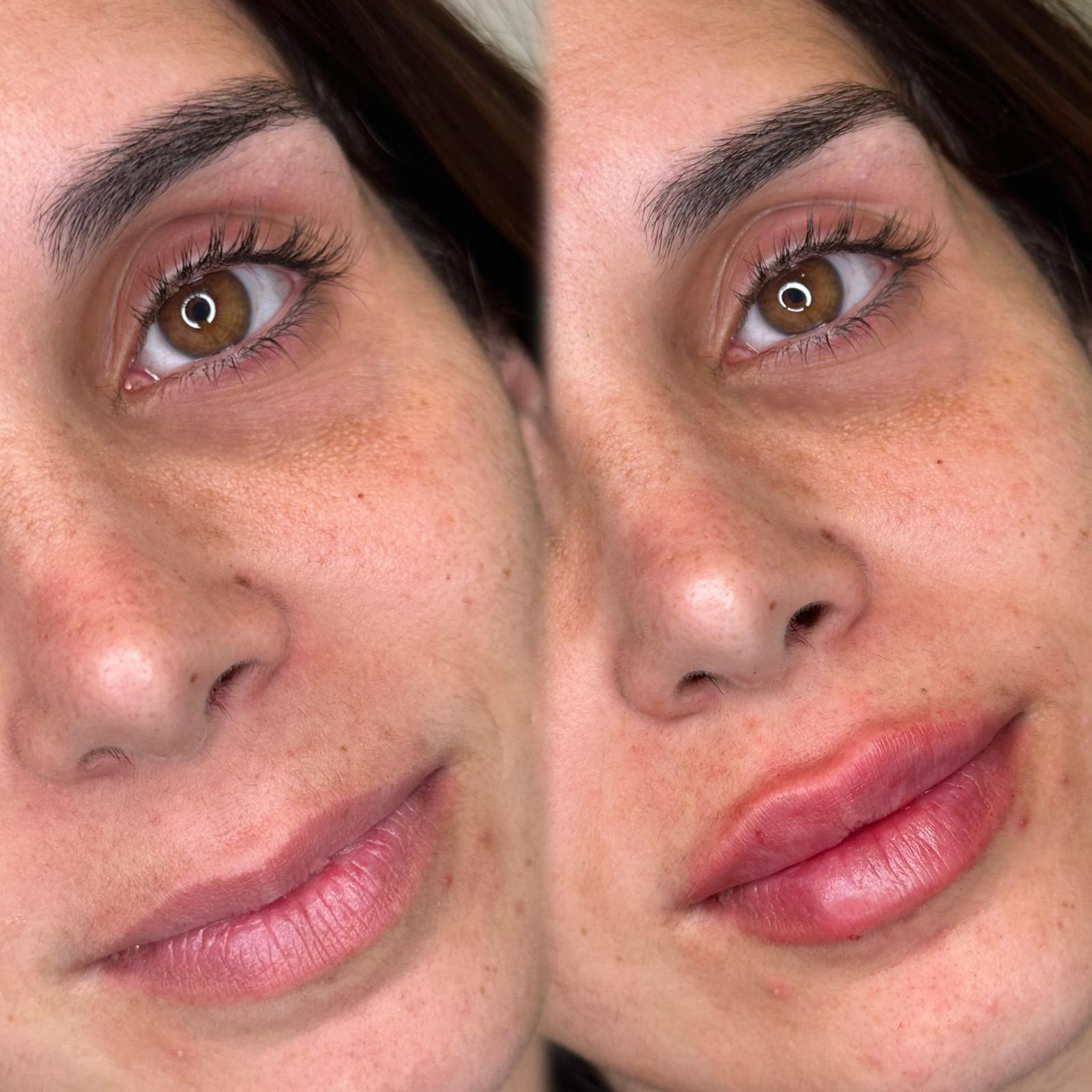 Images Monfer Dermoestetica