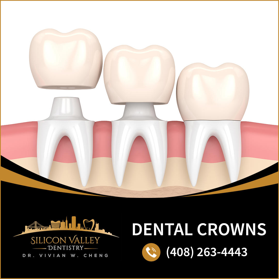 Dr. Vivian Cheng - Dentist In Milpitas | Emergency Dentistry Photo