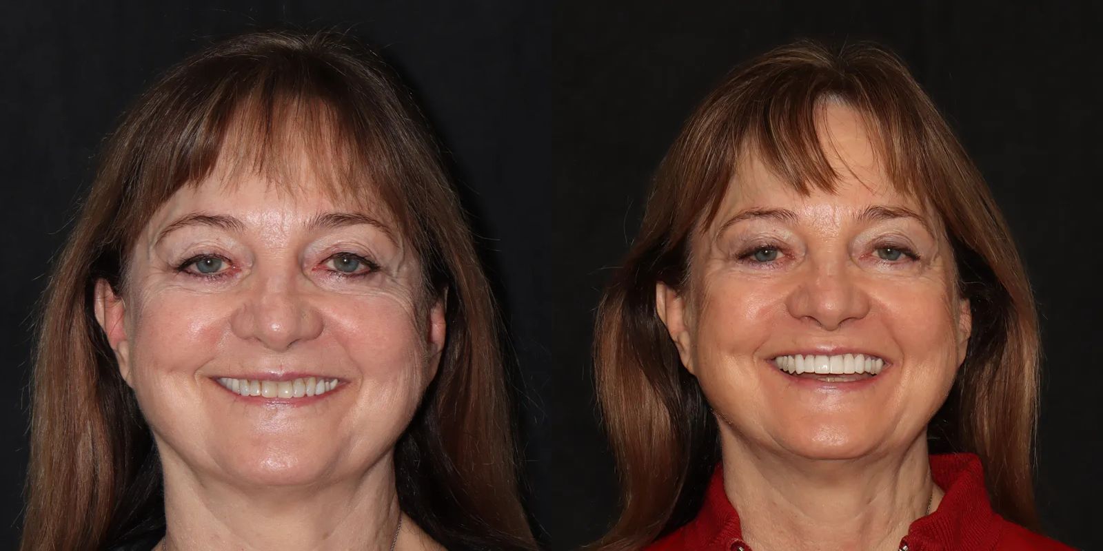 Intermountain Smiles Image