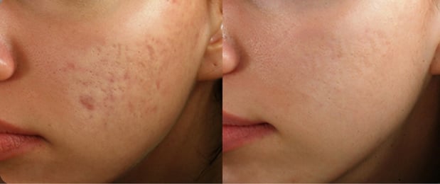 Images Permanent Makeup & Aesthetics in Maine