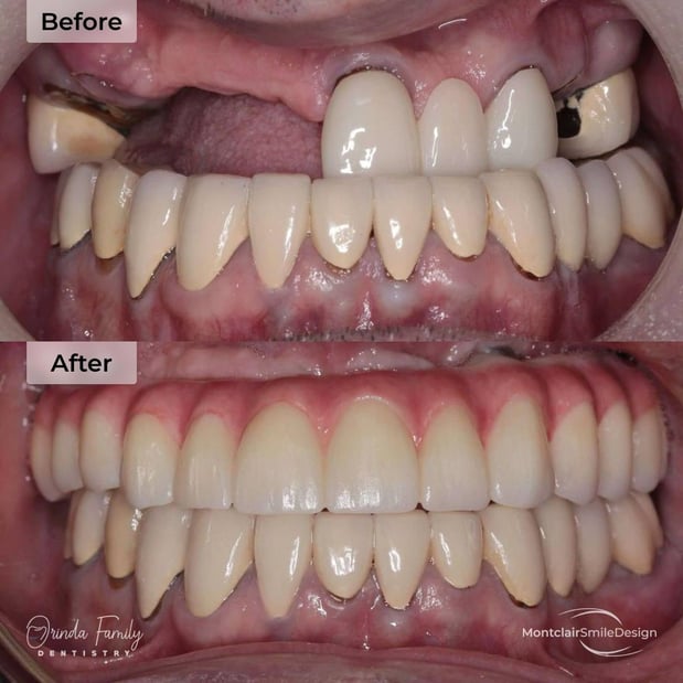 Images Orinda Family Dentistry