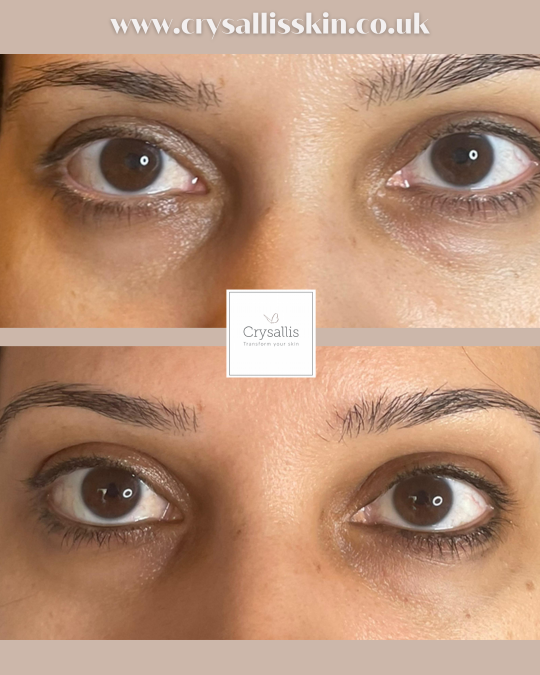 Images Crysallis Skin Clinic