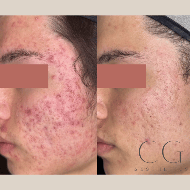 Images Cedar Grove Aesthetics