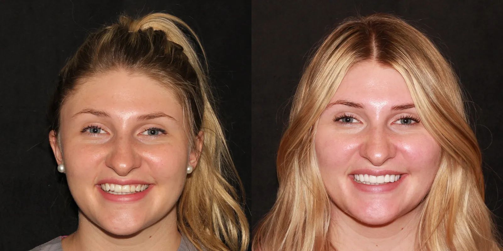 Intermountain Smiles Image