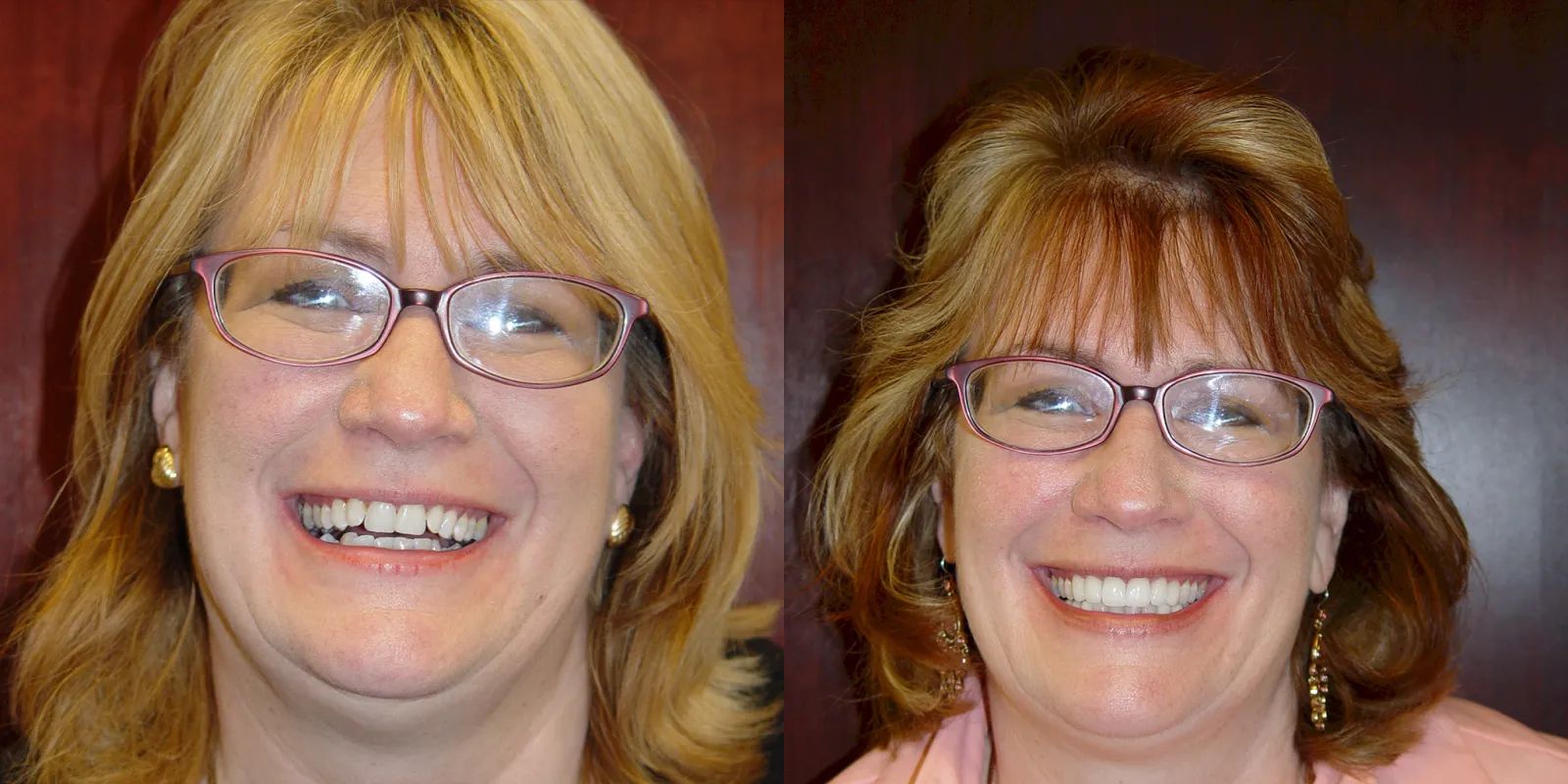 Intermountain Smiles Image