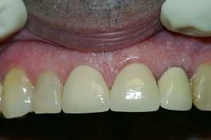 Images Tierrasanta Plaza Dental