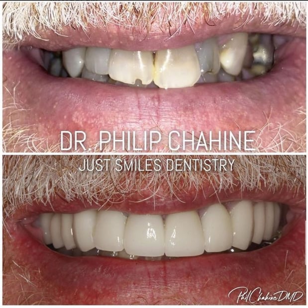 Images Just Smiles - General, Cosmetic & Implant Dentistry