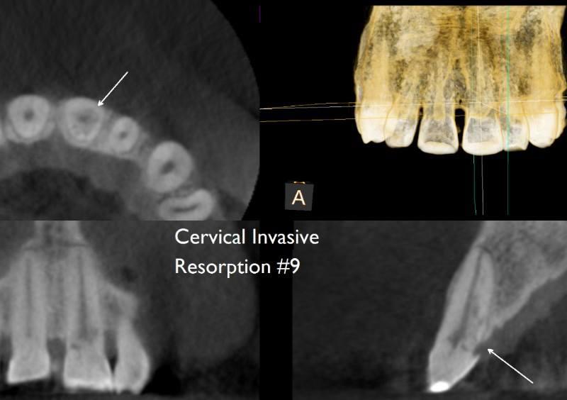 Images Tyler F Baker, DDS MS - Endodontic Specialists