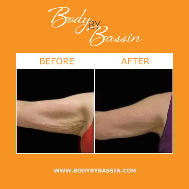 Images Body By Bassin Melbourne
