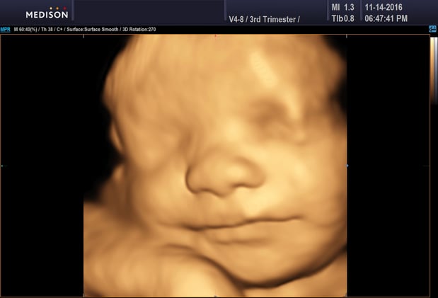 Images Heavenly 3D 4D Ultrasounds