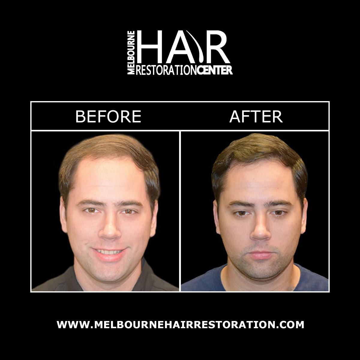 Melbourne Hair Restoration Center Image