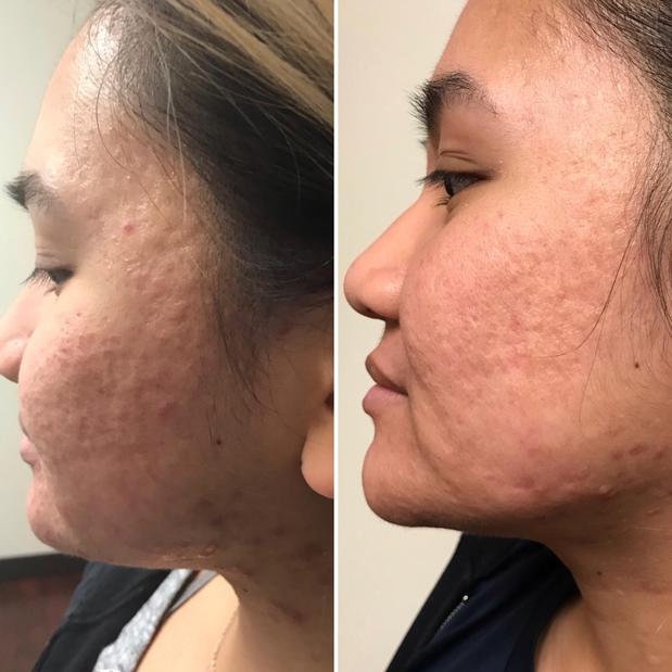 Images RAREV Med Spa