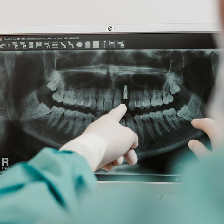 MundWerk Praxisklinik für Oralchirurgie und Implantologie, Friedrichstraße 12-18 in Metzingen