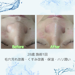 Images Blue beedro -メンズ美肌科学研究所-