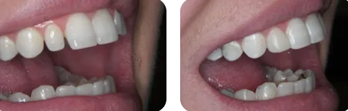 Images Paige Prather Smiles