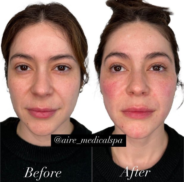 Images Aire Medical Spa