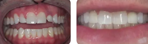 Images Paige Prather Smiles