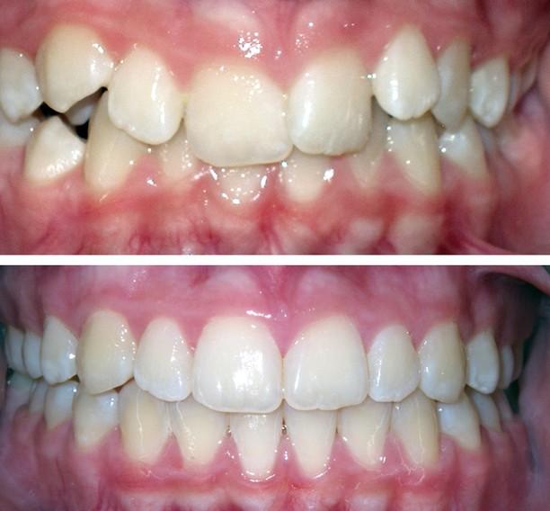 Images Smiles By Eddie: Dr. Edmond Ahdoot DDS