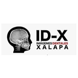 ID-X imágenes dentales Xalapa Xalapa
