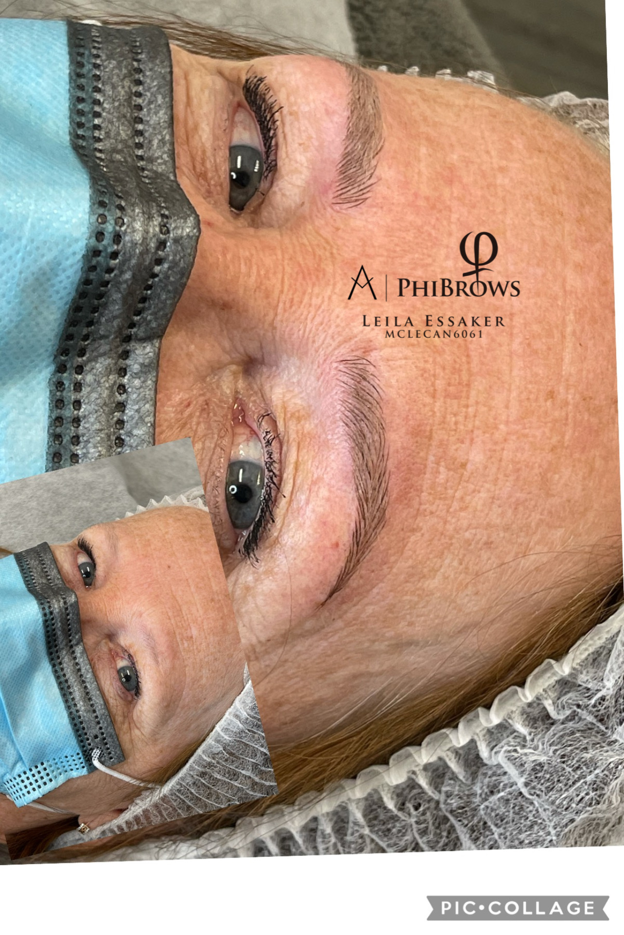 Images Clinique d'Esthétique Leila - Hydrafacial, Microblading, Épilation Laser Sainte-Foy