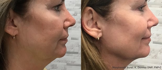 Images EliteBio: Hormone and Aesthetic Solutions