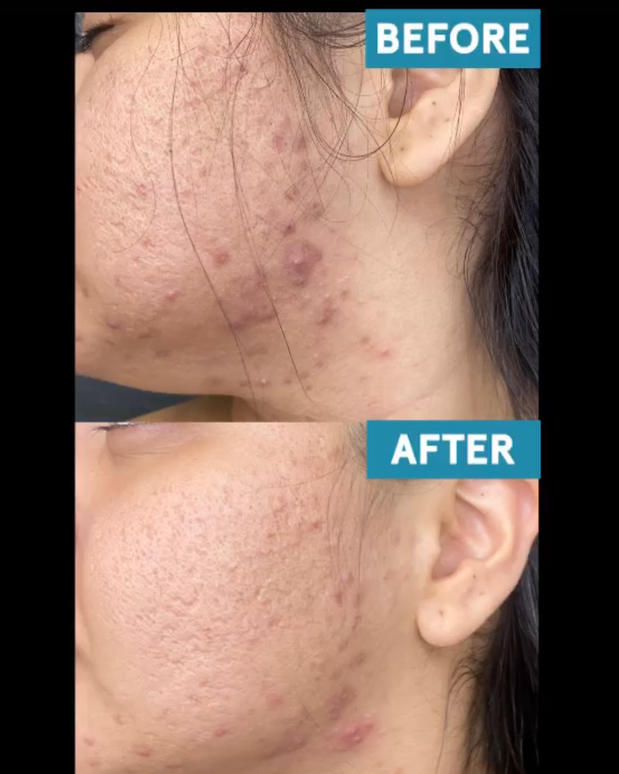 Images RAREV Med Spa