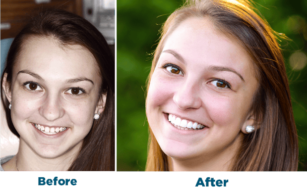 Images Smiles for Life Dental Care - Bridgewater