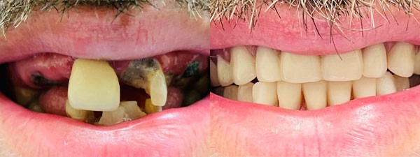 Images Riverside Family Dental