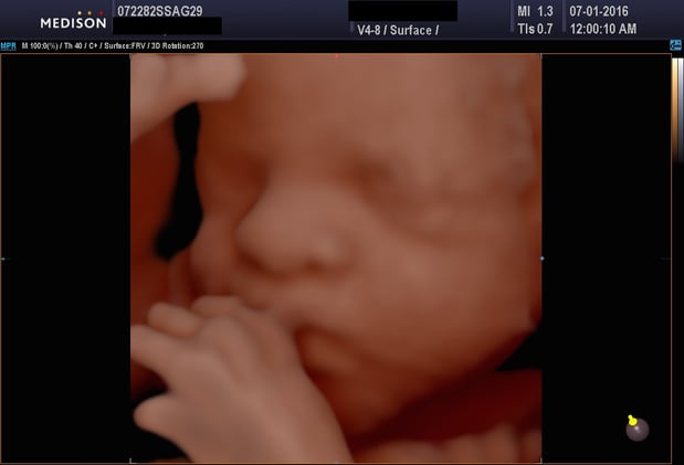 Images Heavenly 3D 4D Ultrasounds