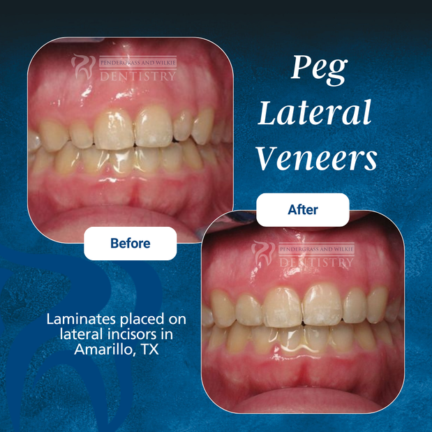 Images Pendergrass and Wilkie Dentistry