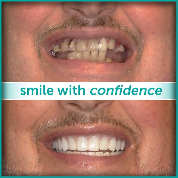 Images St. Louis County Dental Partnership