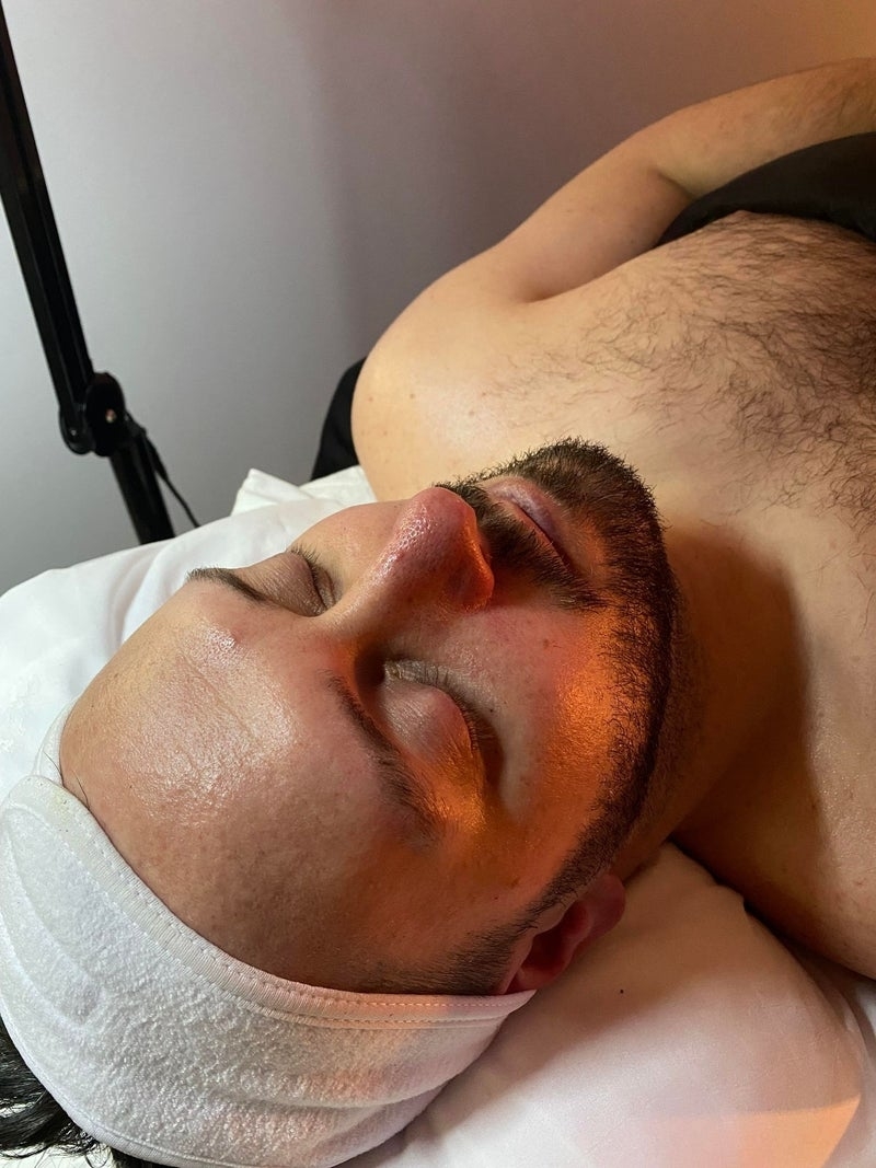 Images Onyx Esthétique - Soins esthétiques, Soins de la peau, Laser Cynosure Gatineau