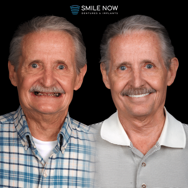 Images Smile Now Milwaukee Dentures and Implants