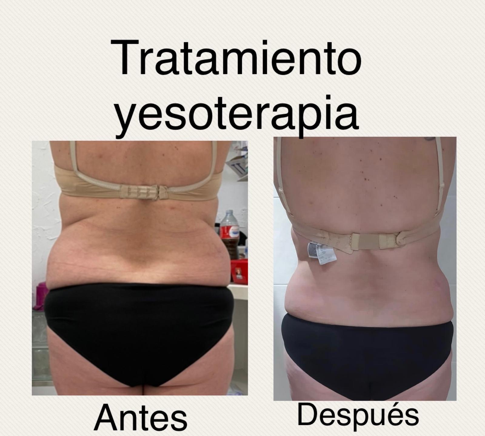 Images Centro De Estética Avanzada Y Láser Verónica Vico