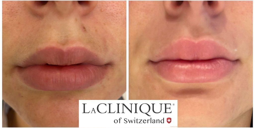 Bilder LaCLINIQUE of Switzerland