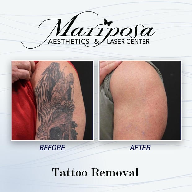 Images Mariposa Aesthetics & Laser Center