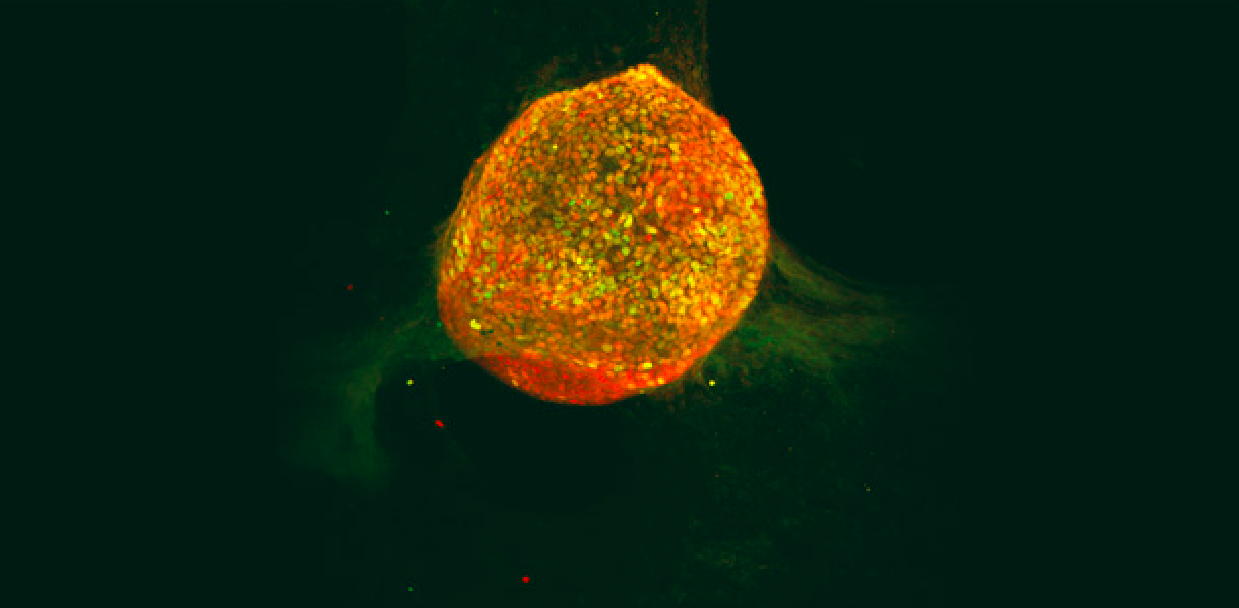 Microimaging novel technology to transform stem cells into insulin producing cells