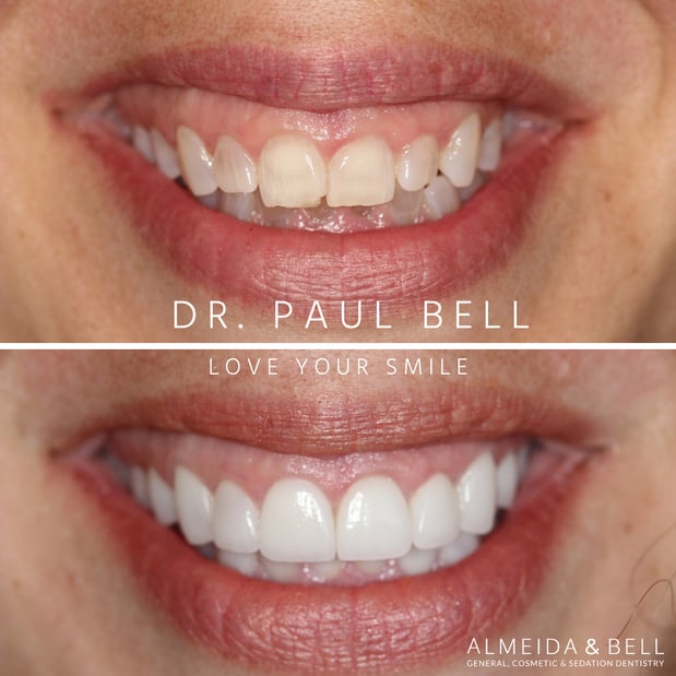 Images Almeida & Bell Dental Lone Tree - General, Cosmetic, and Implant Dentistry