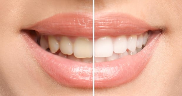 Images Emergency Dental of Phoenix