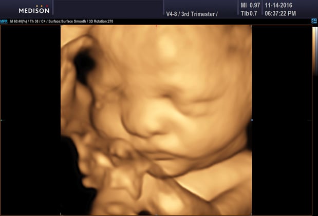 Images Heavenly 3D 4D Ultrasounds