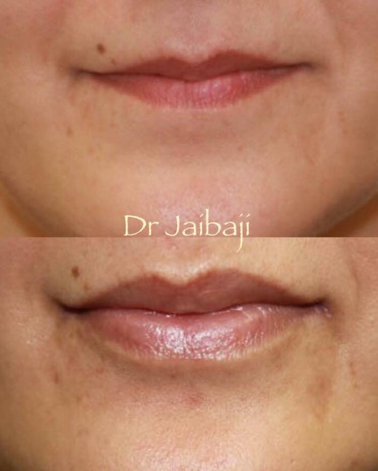 Jaibaji Plastic Surgery Photo