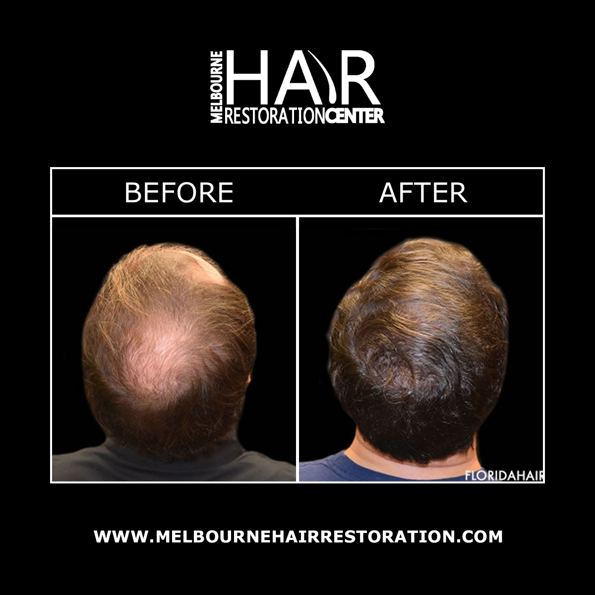 Melbourne Hair Restoration Center Image