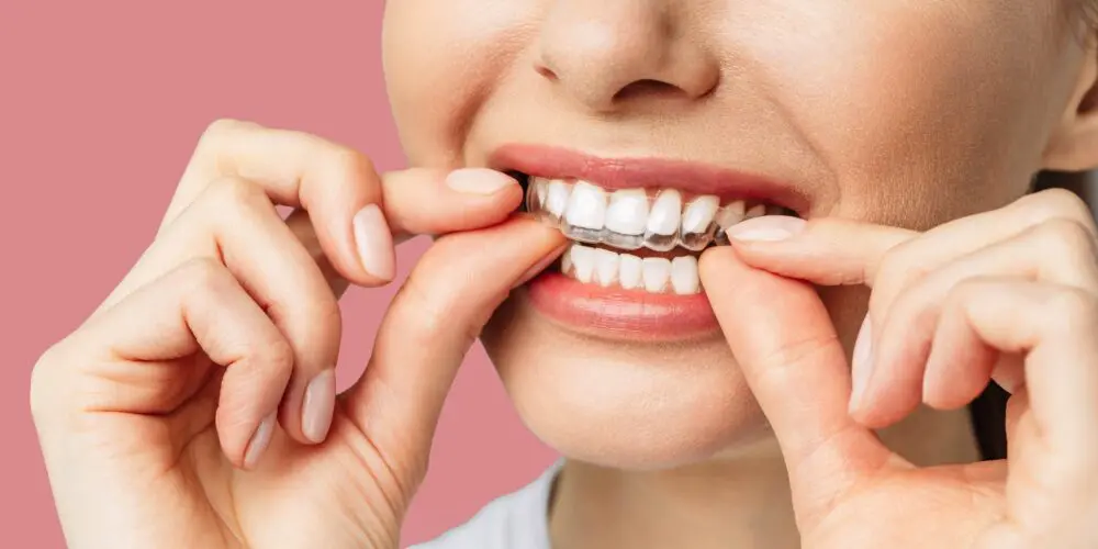 Bilder thesmile.ch - Ihre Experten für Ästhetische Zahnmedizin