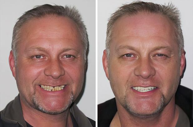 Images Staten Island Aesthetic & Implant Dentist