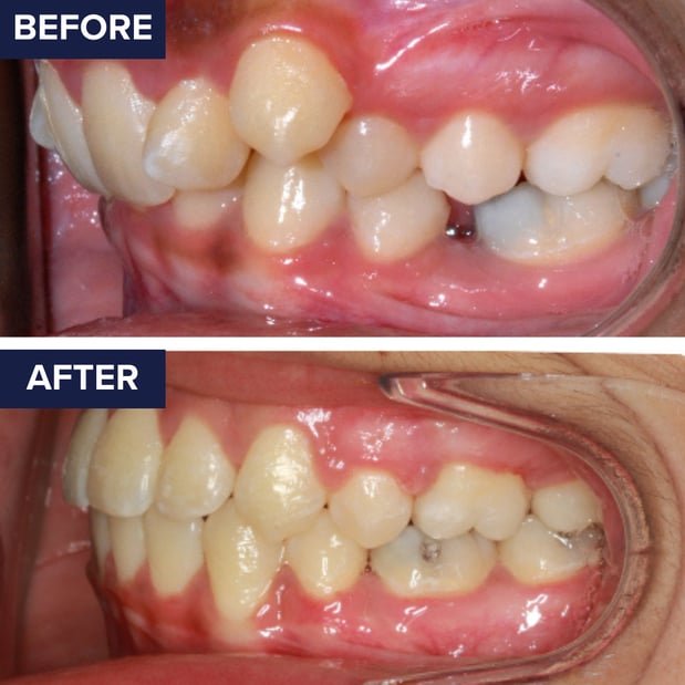 Images Orthodontics of Santa Barbara