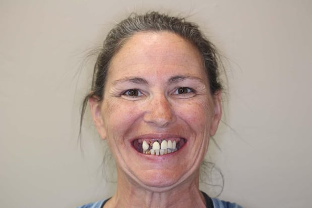 Images Paladin Dental